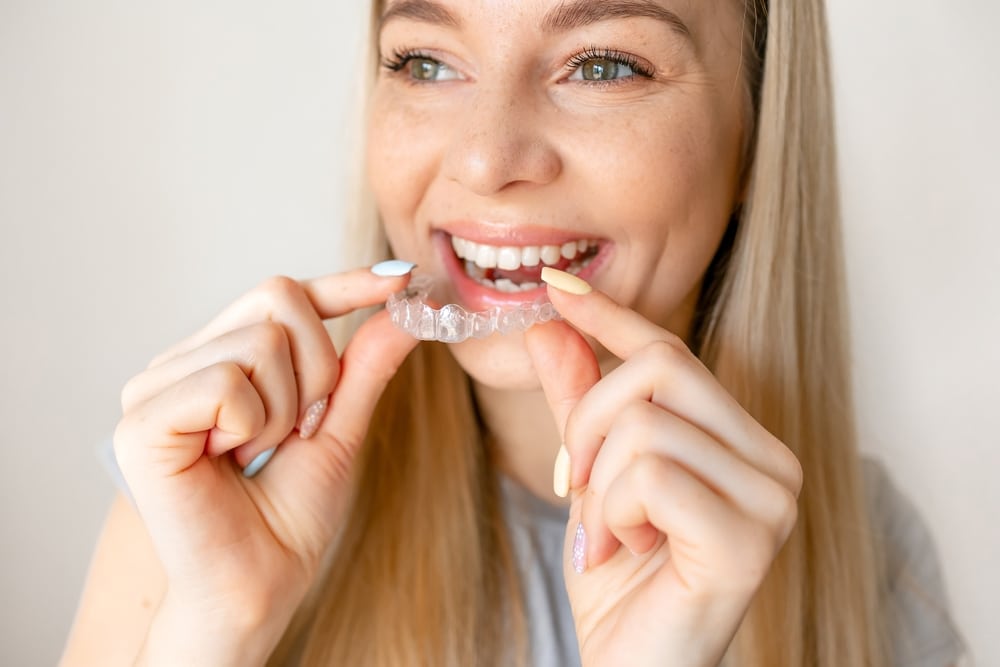 Invisalign in Chattanooga